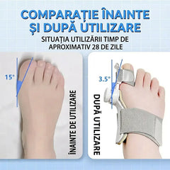 【2 buc】Corector Ortopedic pentru Monturi și Hallux Valgus, cu Buton Rotativ Ajustabil 0-45° – Dispozitiv Medical Fără Durere, Zi și Noapte